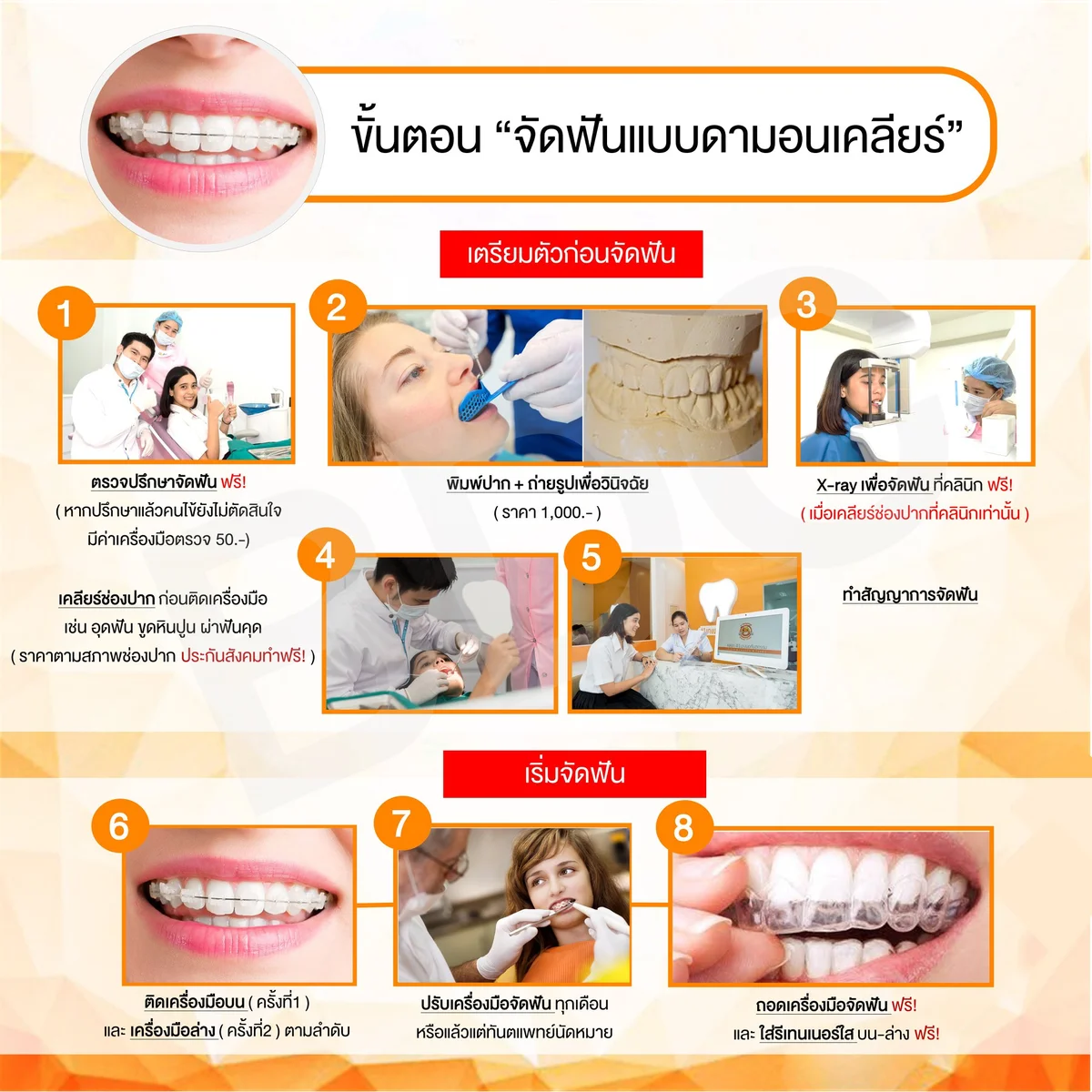 damon clear braces treatment steps damon clear braces treatment steps