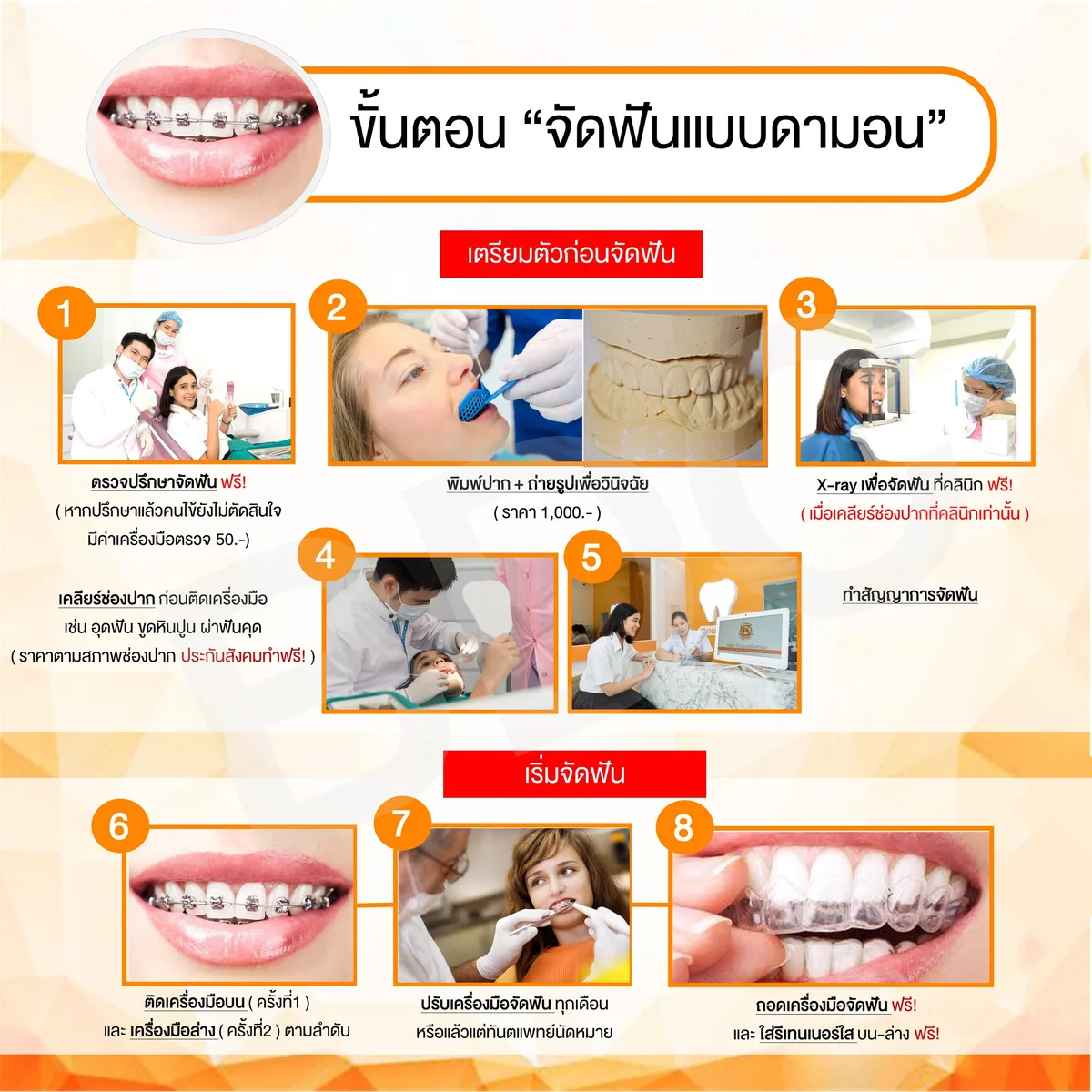 damon self ligating braces treatment steps damon self ligating braces treatment steps