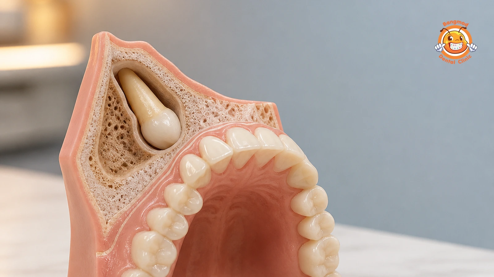 embedded tooth removal featured