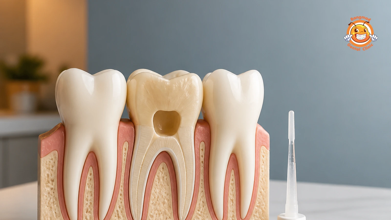 internal bleaching featured