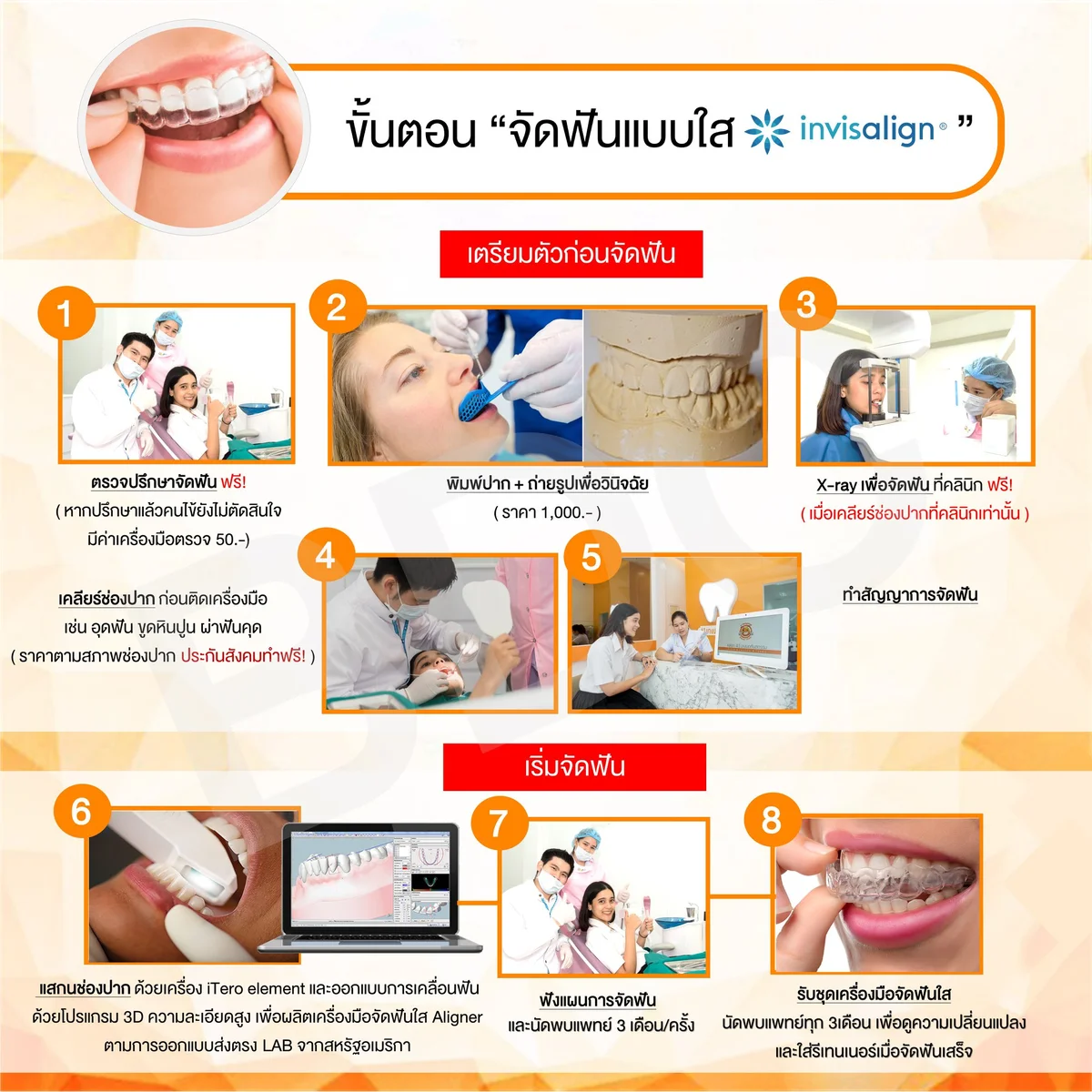 invisalign clear aligner treatment steps