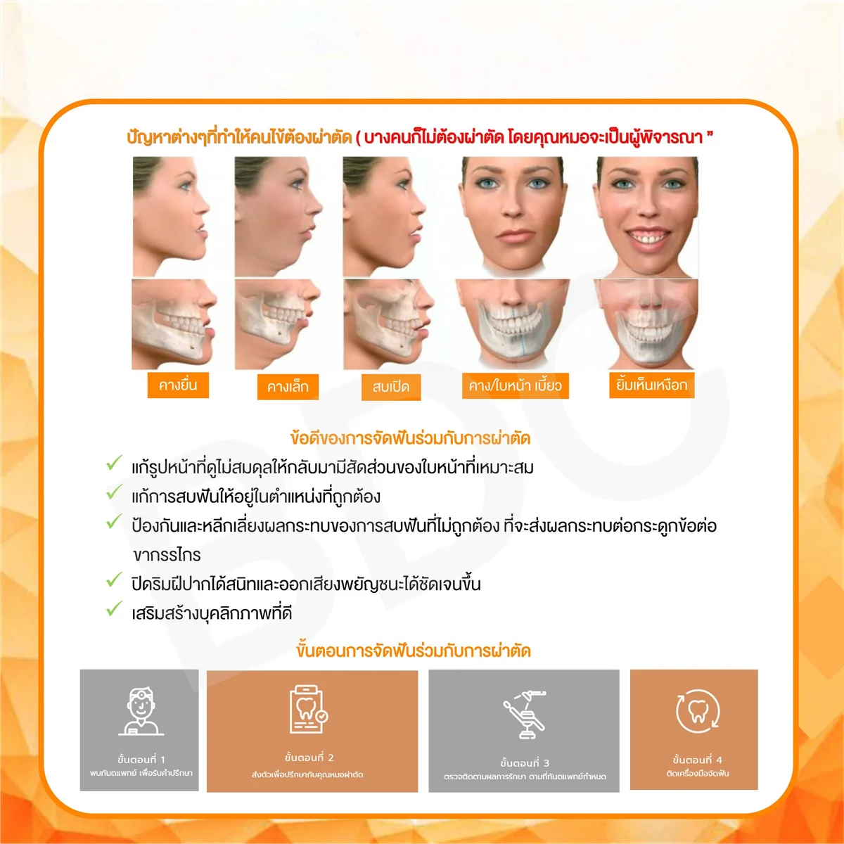 orthognathic surgery jaw problems explained orthognathic surgery jaw problems explained