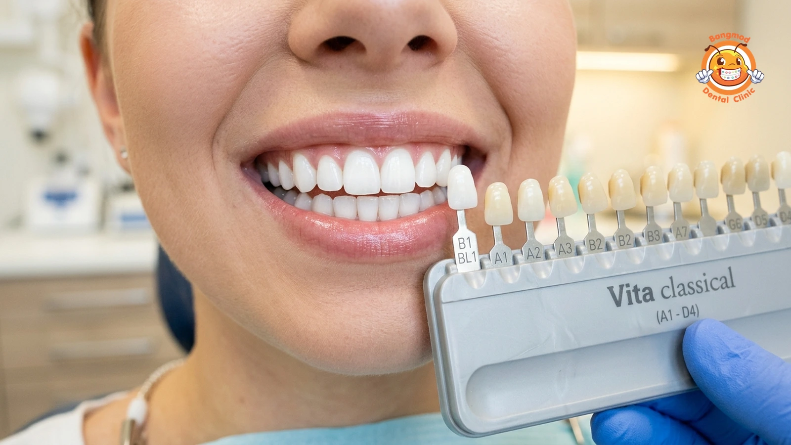 teeth whitening featured